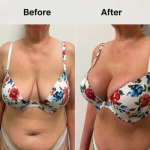Restore Lift & Volume to Sagging Breasts in Just 14 Days